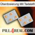 Überdosierung Mit Tadalafil 25